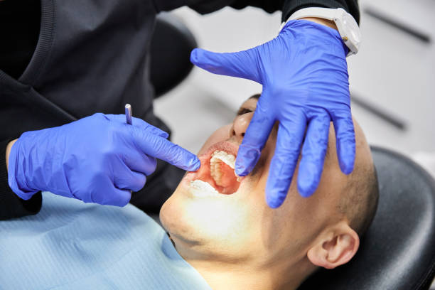 Best Emergency Dental Care for Abscessed Tooth in Munsey Park, NY