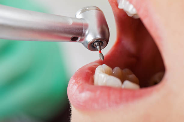 Best Emergency Dentist for Special Needs Patients in Munsey Park, NY